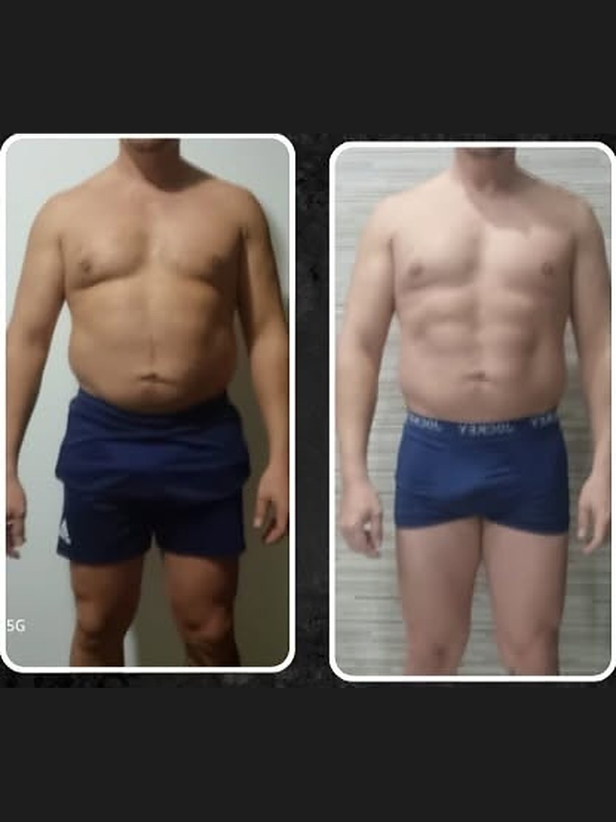 One of the six client before and afters on Leo&rsquo;s own published plate, front on, 4 of 6